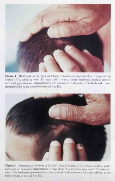 Image result for chanai choomalaiwong